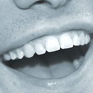 Mondhygiënist van het Noorden